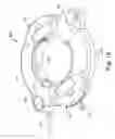 Fig. 24 - Burr hole anchors, systems, and methods