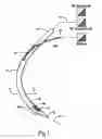 Fig. 02 - SURGICAL INSTRUMENTS AND TECHNIQUES FOR TREATING GASTRO-ESOPHAGEAL REFLUX DISEASE