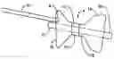 Fig. 01 - Gastric retaining devices and methods