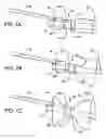 Fig. 02 - Gastric retaining devices and methods
