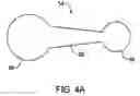 Fig. 05 - Gastric retaining devices and methods