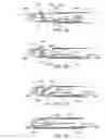 Fig. 12 - Apparatus and methods for material capture and removal
