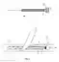 Fig. 02 - Acupuncture needle and an acupuncture needle guide assembly