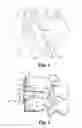 Fig. 02 - Spinal implant having a resorbable anchor device for temporarily securing an interbody device to adjacent upper and lower vertebrae