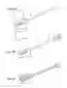 Fig. 07 - Biologic vertebral reconstruction