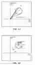 Fig. 04 - Interference rejection through circle fitting
