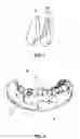 Fig. 02 - Method for creating a personalized digital planning file for simulation of dental implant placement