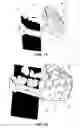 Fig. 07 - Method for creating a personalized digital planning file for simulation of dental implant placement