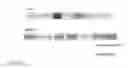 Fig. 03 - Cre-lox based gene knockdown constructs and methods of use thereof