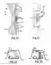 Fig. 09 - Roof ditch molding retainer