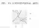Fig. 09 - Printed circuit board, semiconductor package, card apparatus, and system