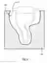 Fig. 05 - Fabrication of a soft-silicone cover for a hearing instrument shell