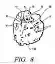 Fig. 08 - System and method for video medical examination and real time transmission to remote locations
