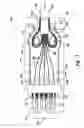 Fig. 05 - DEVICE FOR FURCATING FIBER OPTIC CABLES