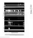 Fig. 167 - METHODS AND NUCLEIC ACIDS FOR THE ANALYSIS OF GENE EXPRESSION ASSOCIATED WITH TISSUE CLASSIFICATION