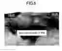 Fig. 06 - Fabrication method of semiconductor device