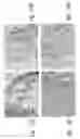 Fig. 09 - Method of in situ bioproduction and composition of bacterial cellulose nanocomposites