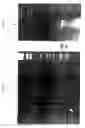 Fig. 09 - AGENTS FOR PRE-SYMPTOMATIC DETECTION AND THERAPEUTIC TARGETING OF ALZHEIMER'S DISEASE AND DOWN SYNDROME IN HUMANS