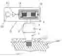 Fig. 02 - Bone conducting hearing aid with connection