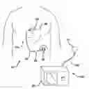 Fig. 01 - Methods and devices for measuring impedance in a gastric restriction system