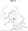 Fig. 02 - Methods and devices for measuring impedance in a gastric restriction system