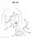 Fig. 02 - Gastric restriction device data handling devices and methods