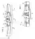 Fig. 02 - Highly Adjustable Lumbar Support And Methods