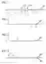 Fig. 02 - BLOOD FLOW BLOCKING CATHETER
