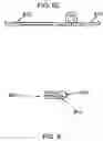 Fig. 06 - Pedicle-laminar dynamic spinal stabilization device