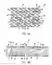 Fig. 07 - Intravascular stent with a plurality of first and second peaks