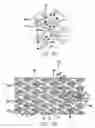 Fig. 08 - Intravascular stent with a plurality of first and second peaks