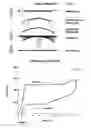 Fig. 02 - Systems and methods for wrought nickel/titanium alloy flexible spinal rods
