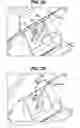 Fig. 04 - WET CEMENT DISPENSING APPARATUS WITH CLEANING AND ACCESS FEATURES