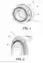 Fig. 02 - Sealing for ball-and-socket joints and use thereof