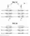 Fig. 49 - Live conductor stringing and splicing method and apparatus