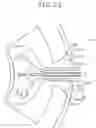 Fig. 09 - Spindle motor having recess for accomodating terminal