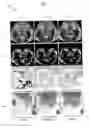 Fig. 06 - Facial performance synthesis using deformation driven polynomial displacement maps