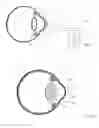 Fig. 15 - Vision modification with reflected image