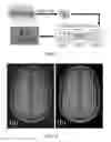 Fig. 02 - Auto calibration parallel imaging reconstruction method from arbitrary k-space sampling