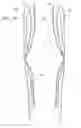 Fig. 22 - BAG WITH IMPROVED FEATURES