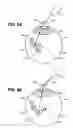 Fig. 09 - Drug delivery devices, kits and methods therefor