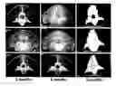 Fig. 01 - Highly mineralized osteogenic sponge compositions and uses thereof