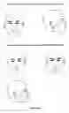 Fig. 02 - Preventing/Treating signs of skin stress/aging by bioenergetically modifying acupuncture points of the face or neck