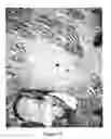 Fig. 09 - Culturing human embryonic stem cells with a noggin to generate cells lacking Pax-6 expression