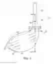 Fig. 02 - Interchangeable shaft system