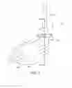 Fig. 02 - Interchangeable shaft system