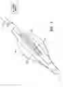 Fig. 09 - Multilumen brachytherapy balloon catheter