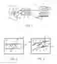 Fig. 02 - CHARACTERIZATION OF VULNERABLE PLAQUE USING DYNAMIC ANALYSIS