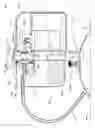 Fig. 02 - Suctioning system, method and kit
