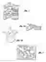 Fig. 02 - DEVICE AND METHOD FOR STABILIZING A DAMAGED BONE WITH A BONE CEMENT MIXTURE